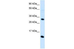 WB Suggested Anti-CCL18  Antibody Titration: 0. (CCL18 抗体  (Middle Region))