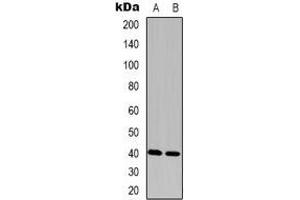Western blot analysis of FAM203A expression in Hela (A), Colo320 (B) whole cell lysates. (FAM203B 抗体)