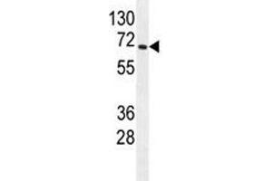 S6K2 antibody western blot analysis in mouse heart tissue lysate. (RPS6KB2 抗体)