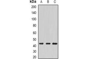 Western blot analysis of ECSIT expression in HepG2 (A), mouse kidney (B), mouse heart (C) whole cell lysates. (ECSIT 抗体)