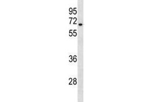 HAS3 antibody western blot analysis in A549 lysate. (HAS3 抗体  (AA 137-164))