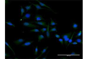 Immunofluorescence (IF) image for anti-Cyclin D2 (CCND2) (AA 1-289) antibody (ABIN514106)
