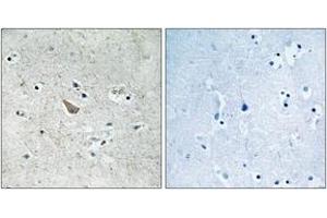 Immunohistochemistry analysis of paraffin-embedded human brain, using Ephrin B1/B2 (Phospho-Tyr329) Antibody. (Ephrin B1/B2 (AA 295-344), (pTyr329) 抗体)