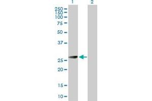 Western Blot analysis of BCAP31 expression in transfected 293T cell line by BCAP31 MaxPab polyclonal antibody. (BCAP31 抗体  (AA 1-246))