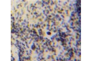Used in DAB staining on fromalin fixed paraffin-embedded Spleen tissue (GDF3 抗体  (AA 253-366))