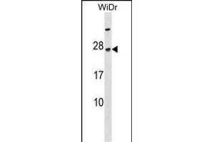 TGIF2LY Antibody (N-term) (ABIN1538862 and ABIN2849859) western blot analysis in WiDr cell line lysates (35 μg/lane). (TGIF2LY 抗体  (N-Term))