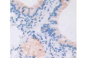 Figure. (TBX3 抗体  (AA 107-220))