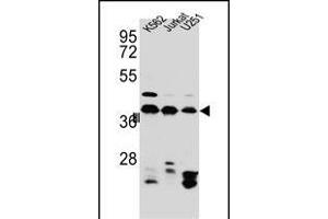 HNRNPC Antibody (C-term) (ABIN654685 and ABIN2844378) western blot analysis in Jurkat,K562, cell line lysates (35 μg/lane).