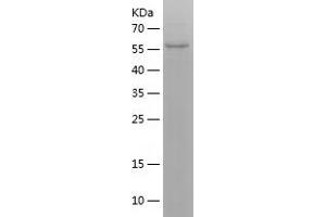 Western Blotting (WB) image for Cathepsin L2 (CTSL2) (AA 18-334) protein (His-IF2DI Tag) (ABIN7122183) (Cathepsin L2 Protein (CTSL2) (AA 18-334) (His-IF2DI Tag))
