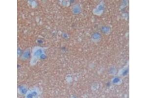 IHC-P analysis of Kidney tissue, with DAB staining. (C6orf150 抗体  (AA 225-407))