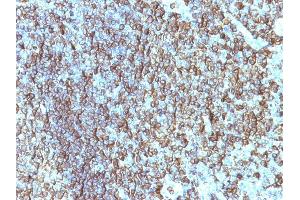 Formalin-fixed, paraffin-embedded human Tonsil stained with HLA-DRB Monoclonal Antibody (SPM288). (HLA-DRB1 抗体)