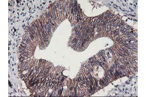 Image no. 1 for anti-Arachidonate 15-Lipoxygenase (ALOX15) antibody (ABIN1496359) (ALOX15 抗体)