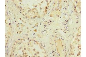 Immunohistochemistry of paraffin-embedded human testis tissue using ABIN7176632 at dilution of 1:100 (ZFPM2 抗体  (AA 982-1151))
