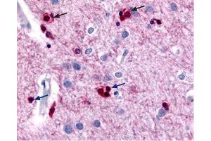 Immunohistochemistry (IHC) image for anti-Potassium Intermediate/small Conductance Calcium-Activated Channel, Subfamily N, Member 2 (KCNN2) (AA 542-559), (Intracellular) antibody (ABIN7043461)
