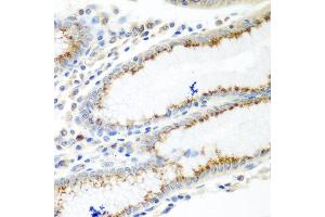 Immunohistochemistry of paraffin-embedded human stomach using UBIAD1 antibody at dilution of 1:100 (40x lens). (UBIAD1 抗体)