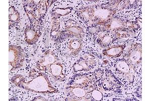 Immunohistochemistry (IHC) image for anti-Baculoviral IAP Repeat-Containing 5 (BIRC5) (AA 85-142) antibody (ABIN670911)