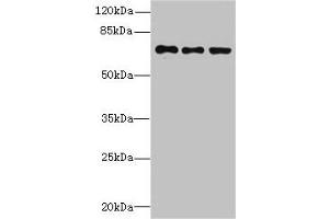 Western blot All lanes: ZNF614 antibody at 6 μg/mL Lane 1: Jurkat whole cell lysate Lane 2: HepG2 whole cell lysate Lane 3: A549 whole cell lysate Secondary Goat polyclonal to rabbit IgG at 1/10000 dilution Predicted band size: 68, 23 kDa Observed band size: 68 kDa (ZNF614 抗体  (AA 1-198))