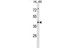 Western Blotting (WB) image for anti-Regulator of G-Protein Signaling 11 (RGS11) antibody (ABIN2999155) (RGS11 抗体)