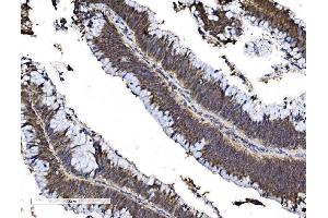 IHC analysis of FOXA2 using anti-FOXA2 antibody (ABIN7600003). (FOXA2 抗体  (AA 139-446))