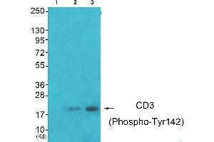 Western blot analysis of extracts from JK cells (Lane 2) and K562 cells (Lane 3), using CD3 zeta (Phospho-Tyr142) antibody. (CD247 抗体  (pTyr142))