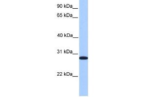 WB Suggested Anti-CDKN3 Antibody Titration: 0. (CDKN3 抗体  (C-Term))