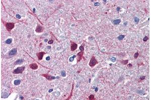 Human Brain, Cortex: Formalin-Fixed, Paraffin-Embedded (FFPE) (Retinoic Acid Receptor beta 抗体  (C-Term))