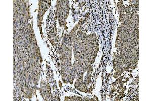 IHC analysis of SNRPN using anti-SNRPN antibody (ABIN3043934).