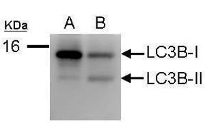 Western Blotting (WB) image for anti-Microtubule-Associated Protein 1 Light Chain 3 beta (MAP1LC3B) antibody (ABIN2854667)