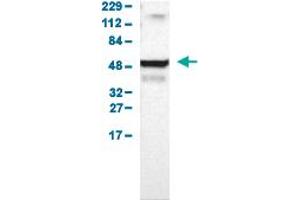 Western Blot analysis of human cell line RT-4. (UCKL1 抗体  (AA 86-203))