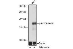 Western blot analysis of extracts of 293T cells using Phospho-RPTOR(Ser792) Polyclonal Antibody at dilution of 1:1000. (Raptor 抗体  (pSer792))