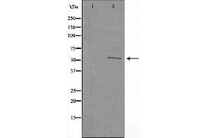 Western blot analysis of extracts from A549 cells using RAD23B antibody. (RAD23B 抗体  (N-Term))