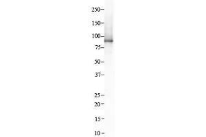 Host:  Rabbit  Target Name:  ITGB8  Sample Type:  Human Kidney  Antibody Dilution:  1. (ITGB8 抗体  (C-Term))