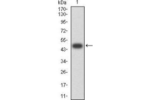 Western blot analysis using CD161 mAb against human CD161 (AA: extra 67-225) recombinant protein. (CD161 抗体  (AA 67-225))