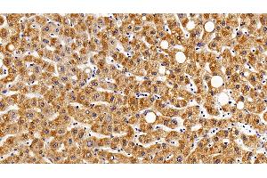 Detection of gp130 in Human Liver Tissue using Polyclonal Antibody to Glycoprotein 130 (gp130) (CD130/gp130 抗体  (AA 392-566))