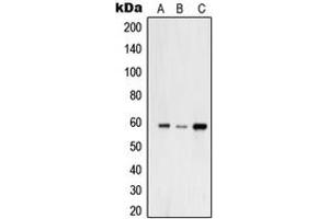 Western blot analysis of USP30 expression in A549 (A), HeLa (B), THP1 (C) whole cell lysates. (Usp30 抗体  (N-Term))