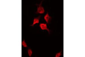 ABIN6267501 staining HeLa by IF/ICC. (p21 抗体  (pThr145))
