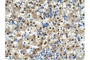 GDE1 antibody was used for immunohistochemistry at a concentration of 4-8 ug/ml to stain Hepatocytes (arrows) in Human Liver. (GDE1 抗体  (N-Term))