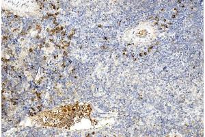 Immunohistochemistry (Paraffin-embedded Sections) (IHC (p)) image for anti-Gremlin 1 (GREM1) (AA 147-175), (C-Term) antibody (ABIN390078)