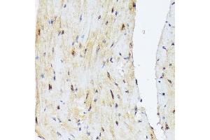 Immunohistochemistry (IHC) image for anti-Proteasome (Prosome, Macropain) 26S Subunit, Non-ATPase, 14 (PSMD14) antibody (ABIN7269588)