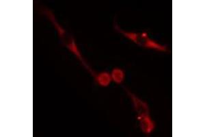 ABIN6272622 staining HepG2 cells by IF/ICC. (NRBP1 抗体  (Internal Region))