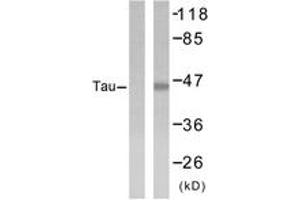 Western blot analysis of extracts from 293 cells, treated with UV, using Tau (Ab-404) Antibody. (tau 抗体  (AA 691-740))