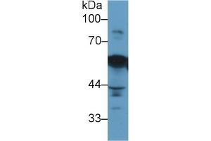 Western Blotting (WB) image for anti-Vimentin (VIM) antibody (ABIN7426163)
