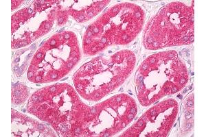 Anti-GNPDA1 antibody IHC of human kidney. (GNPDA1 抗体  (AA 100-150))