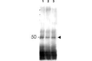 Western blot using MER2 polyclonal antibody  shows detection of phosphorylated and unphosphorylated MER2 in wild type, phosphatase treated and mutant cells. (CD151 抗体  (AA 26-35))