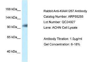 Western Blotting (WB) image for anti-KAT8 Regulatory NSL Complex Subunit 1 (KANSL1) (N-Term) antibody (ABIN2786110) (KANSL1 抗体  (N-Term))