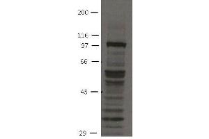 Image no. 1 for anti-Fibroblast Growth Factor Receptor 4 (FGFR4) (Cytoplasmic Domain) antibody (ABIN1169685) (FGFR4 抗体  (Cytoplasmic Domain))
