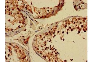 Immunohistochemistry of paraffin-embedded human testis tissue using ABIN7148821 at dilution of 1:100 (CREB3L4 抗体  (AA 13-133))