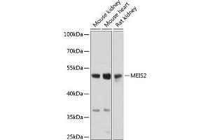 Western blot analysis of extracts of various cell lines, using MEIS2 antibody (ABIN6128272, ABIN6143723, ABIN6143724 and ABIN6224498) at 1:1000 dilution. (MEIS2 抗体  (AA 351-470))