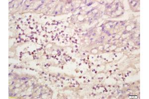 Formalin-fixed and paraffin embedded human liver labeled with Anti-phospho-ERK1/2(Thr202 + Tyr204) Polyclonal Antibody, Unconjugated (ABIN682933) at 1:200 followed by conjugation to the secondary antibody and DAB staining