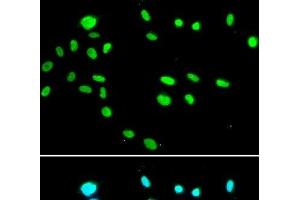 Immunofluorescence analysis of A549 cells using RUVBL1 Polyclonal Antibody (RUVBL1 抗体)